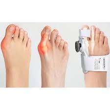 Image result for vybočený palec ortéza