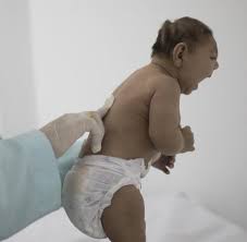 Nun bleibt es am neuen präsidenten der usa, wie mit dem problem zika weiterhin verfahren wird. Zika Virus Virus Kann Auch Gehirne Erwachsener Schadigen Welt