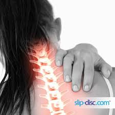 Your spinal column is an intricate network of nerves and blood vessels. Neck Pain And Slip Disc Cause And Non Surgical Treatment Options