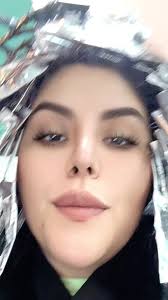 Eijimos que íbamos a regresar con todo así que que venga el análisis  facial! Ya se la saben! Nos hacemos chiquitas! 🩷#botox #fillers  #acidohialuronico #medicinaestetica #capcut #cambiodelook #trend