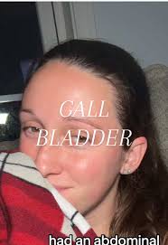 Gallbladder Surgery Recovery Tips You Need