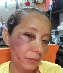 troy.inf MUJER AGREDIDA POR DELINCUENTES #BABAHOYO.- Jenny R, es una  humilde mujer que se gana la vida honradamente vendiendo comida en nuestra  ciudad para mantener a sus hijos y a su padre