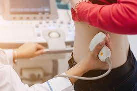 Durere de rinichi este cauzata de infectie, inflamatie, vatamare sau de expandarea rinichilor, sau de cauze care blocheaza fluxul de urina din rinichi. Durerea De Rinichi Cauze Simptome Tratament Preventie Reginamaria Ro