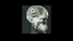 The actual rates and profit are likely to differ. How Much Money Do X Ray Techs Make Youtube