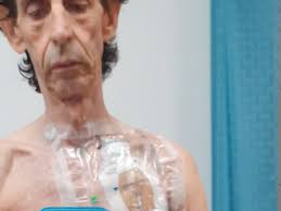 Fundraiser by Yves Roy : C'est le Dernier Espoir pour Sauver ma Vie