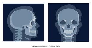 Image result for Skull XRay