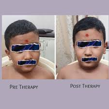 Dr. Chintan Mehta (@physionic_cv) • Instagram photos and videos