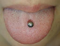 Body Piercing Dermnet Nz