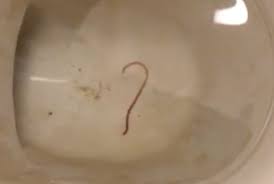 Some types of worms can infect people. Worm In Toilet Bowl Could Be Ascaris Worm Or Earthworm All About Worms