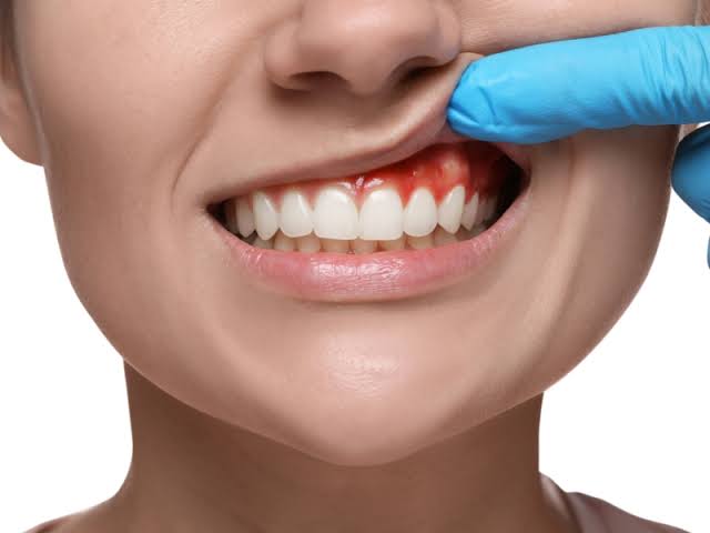Early Signs of Poor Oral Hygiene You Must Not Ignore