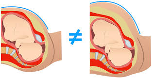 How is the measurement of the fundal height related to how far along in gestation you are? Stop Making Me Look Bad Guys