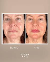 Fresh Face Aesthetics added a new...