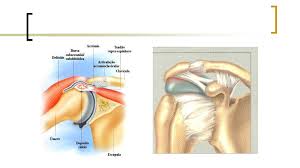 Grátis: Aula 6 - Patologias do ombro - Material Claro e Objetivo em PDF  para Estudo Rápido