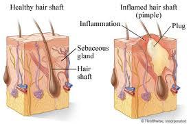Health World All About Neosporin For Pimples