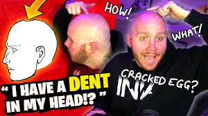 There S A Dent In My Head And Chat Makes Fun Of It Youtube