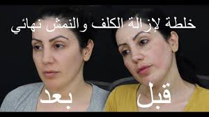خلطة لإزالة الكلف والنمش نهائي Angelica Harmez Youtube Incoming Call Screenshot Incoming Call