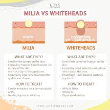 Milia are small white bumps occurring on the skin near the eyes, cheeks and nose of your face. Facebook