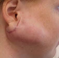 Image result for Dissotis glandulosa