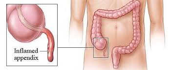 We did not find results for: Sinar Haemodialysis Sinarhdu14 Twitter