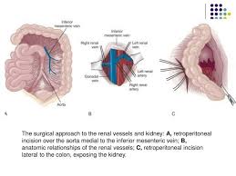 Pin On Renal
