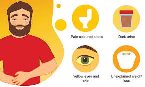 Image result for hepatitis symptoms