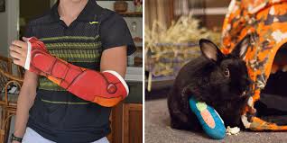 Creative Cast Art That Makes The Best Of A Bad Situation