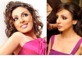 أما عملية الدلفنة فهي عبارة عن عملية ضبط المعدن بين إسطوانتين (دلفينين) دائرتين لماكينة الدلفنة ليشكل حسب الأشكال والأبعاد المطلوبة. Ø¨Ø§Ù„ØµÙˆØ± ÙÙ†Ø§Ù†Ø§Øª Ù‚Ø¨Ù„ ÙˆØ¨Ø¹Ø¯ Ø¹Ù…Ù„ÙŠØ§Øª ØªØ¬Ù…ÙŠÙ„ Ø§Ù„Ø£Ù†Ù Ù…Ø¬Ù„Ø© Ù‡ÙŠ
