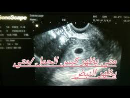 بالرغم من عدم وجود احصائيات متفق عليها عالمياً بعدد المتحدثين بلغة ما، إلا أن هناك بعض المصادر التي تحصي عدد المتحدثين باللغة كلغة أم وقد أجمعت معظم الاحصائيات والمصادر على ترتيب قائمة بعشر لغات في العالم هي الأكثر انتشارا من حيث عدد المتكلمين فيها. Ù…ØªÙŠ ÙŠØ¸Ù‡Ø± ÙƒÙŠØ³ Ø§Ù„Ø¬Ù†ÙŠÙ† ÙÙŠ Ø§Ù„Ø³ÙˆÙ†Ø§Ø± ÙÙŠ Ø§ÙŠ Ø§Ø³Ø¨ÙˆØ¹ ÙŠØ¸Ù‡Ø± Ù†Ø¨Ø¶ Ø§Ù„Ø¬Ù†ÙŠÙ† Youtube