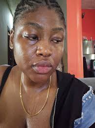 Does anyone recommend a specific appetite suppressant? I keep seeing ads