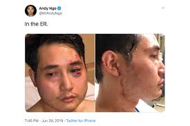 Did Andy Ngo get what he deserved?