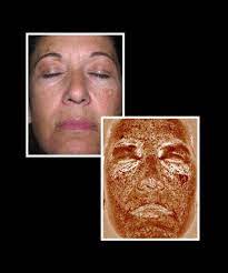 Pin On Sun Awareness Sun Safety