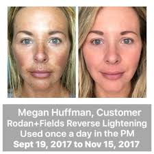 Melasma is difficult but it was a cinch to teach her how to cover it up  with our best selling foundation ￼￼