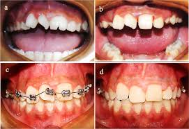 Icd-10 Dental Diagnosis Codes | Study Notes Pathology | Docsity