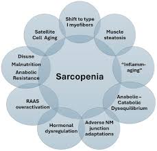 Image result for Dysequilibrium