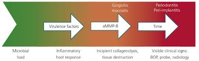 Laboratory Diagnostics For Periodontal Diseases Imd Institut Fur Medizinische Diagnostik Labor
