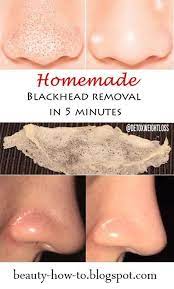 Pin On Blackhead Remover