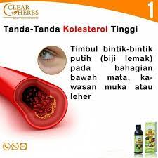 Ciri ciri kolesterol tinggi sering kali tidak disadari oleh seseorang karena tidak menunjukkan tanda tertentu. Tanda Tanda Kolesterol Tinggi Posts Facebook