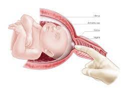 8 Natural Ways To Induce Labor Torontek