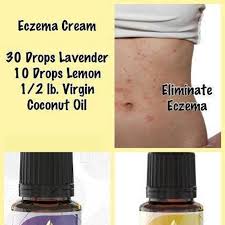 Pin On Skin Body Remedies