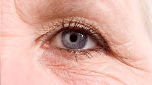 ways to make your eyes look younger