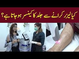 And this may or may not lead to cancer in your future. Does Hair Removal Skin Laser Treatment Causes Cancer Find Side Effects Of It Youtube