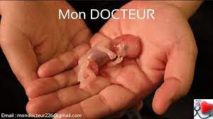 Une fausse couche, est la raison la plus courante de la perte de grossesse selon american college of obstetricians and gynecologists. Mon Docteur Fausses Couches Qu Est Ce Qu Une Fausse Couche La Fausse Couche Aussi Appelee Avortement Spontane Correspond A Un Arret Spontane De La Grossesse Au Cours Des 5 Premiers Mois Avant La