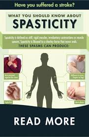 Limited Coordination And Muscle Movement And Painful Muscle Spasms In Your Arms And Legs Spasticity Can Happe Stroke Therapy Stroke Recovery Stroke Exercises