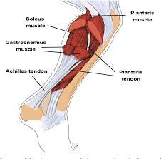 Pdf The Plantaris Tendon In Relation To The Achilles Tendon In Midportion Achilles Tendinopathy Studies On Morphology Innervation And Signalling Substances Semantic Scholar