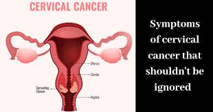 Cervical cancer is one of the main cancers of the female reproductive organs. Here Are 4 Common Signs Of Cervical Cancer To Keep An Eye Out For
