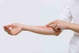 Image result for balanoposthitis