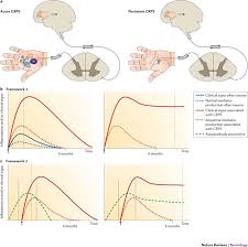 Complex Regional Pain Syndrome Phenotypic Characteristics And Potential Biomarkers Nature Reviews Neurology