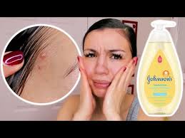 So I washed my face with BABY SOAP for one week...