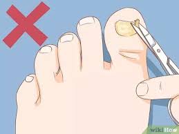 However, this might take a long time. How To Help A Toenail Grow Back Quickly Artofit