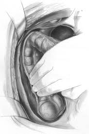 We did not find results for: 22 Colon Carcinoma Treatment Abdominal Key